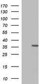 HORMAD2 Antibody - HEK293T cells were transfected with the pCMV6-ENTRY control (Left lane) or pCMV6-ENTRY HORMAD2 (Right lane) cDNA for 48 hrs and lysed. Equivalent amounts of cell lysates (5 ug per lane) were separated by SDS-PAGE and immunoblotted with anti-HORMAD2.