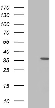 HORMAD2 Antibody - HEK293T cells were transfected with the pCMV6-ENTRY control (Left lane) or pCMV6-ENTRY HORMAD2 (Right lane) cDNA for 48 hrs and lysed. Equivalent amounts of cell lysates (5 ug per lane) were separated by SDS-PAGE and immunoblotted with anti-HORMAD2.