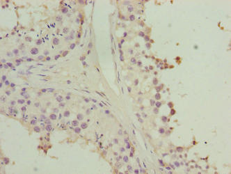 HORMAD2 Antibody - Immunohistochemistry of paraffin-embedded human testis tissue using HORMAD2 Antibody at dilution of 1:100