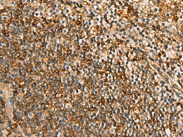 HORMAD2 Antibody - Immunohistochemistry of paraffin-embedded Human tonsil tissue  using HORMAD2 Polyclonal Antibody at dilution of 1:45(×200)