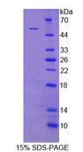 CD71 / Transferrin Receptor Protein - Recombinant  Transferrin Receptor By SDS-PAGE