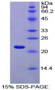 FTL / Ferritin Light Chain Protein - Recombinant Ferritin, Light Polypeptide By SDS-PAGE