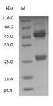 Horse IgG Protein - (Tris-Glycine gel) Discontinuous SDS-PAGE (reduced) with 5% enrichment gel and 15% separation gel.