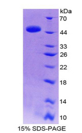 IL-10 Protein - Recombinant Interleukin 10 By SDS-PAGE