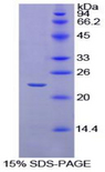 IL-1B / IL-1 Beta Protein - Recombinant Interleukin 1 Beta By SDS-PAGE