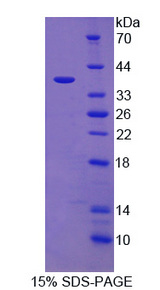 IL12B / IL12 p40 Protein - Recombinant Interleukin 12B By SDS-PAGE