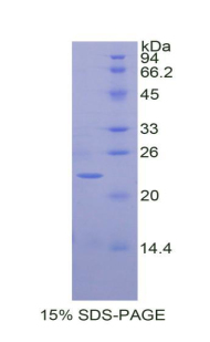 IL1A / IL-1 Alpha Protein - Recombinant Interleukin 1 Alpha By SDS-PAGE