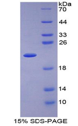 IL1RN Protein - Recombinant Interleukin 1 Receptor Antagonist By SDS-PAGE