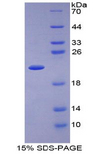 IL1RN Protein - Recombinant Interleukin 1 Receptor Antagonist By SDS-PAGE