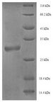 PMP2 / FABP8 Protein - (Tris-Glycine gel) Discontinuous SDS-PAGE (reduced) with 5% enrichment gel and 15% separation gel.