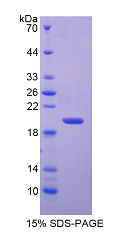 SOD1 / Cu-Zn SOD Protein - Recombinant  Superoxide Dismutase 1, Soluble By SDS-PAGE
