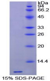 TMSB4X / Thymosin Beta-4 Protein - Recombinant Thymosin Beta 4 By SDS-PAGE