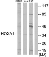 HOXA1 Antibody - Western blot analysis of lysates from HeLa, COLO, and 293 cells, using HOXA1 Antibody. The lane on the right is blocked with the synthesized peptide.