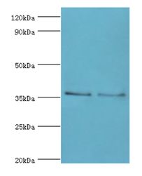HOXA1 Antibody - Western blot. All lanes: HOXA1 antibody at 2 ug/ml. Lane 1: NIH3T3 whole cell lysate. Lane 2: HeLa whole cell lysate. Secondary antibody: Goat polyclonal to rabbit at 1:10000 dilution. Predicted band size: 36 kDa. Observed band size: 36 kDa.