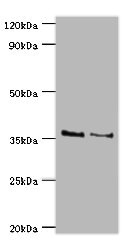 HOXA1 Antibody - Western blot All lanes: HOXA1 antibody at 2µg/ml Lane 1: NIH/3T3 whole cell lysate Lane 2: Hela whole cell lysate Secondary Goat polyclonal to rabbit IgG at 1/10000 dilution Predicted band size: 37, 15, 25 kDa Observed band size: 37 kDa
