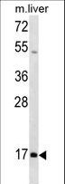 HOXA1 Antibody - HOXA1 Antibody western blot of mouse liver tissue lysates (35 ug/lane). The HOXA1 antibody detected the HOXA1 protein (arrow).