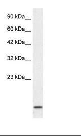 HOXA1 Antibody - Jurkat Cell Lysate.  This image was taken for the unconjugated form of this product. Other forms have not been tested.