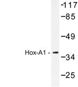 HOXA1 Antibody - Western blot of Hox-A1 (Q203) pAb in extracts from HeLa cells.