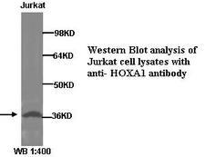 HOXA1 Antibody