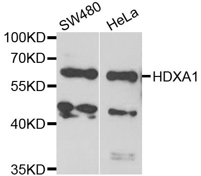 HOXA1 Antibody - Western blot analysis of extracts of various cell lines.