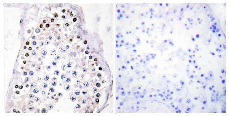 HOXA1/HOXB1/HOXD1 Antibody - Immunohistochemistry analysis of paraffin-embedded human testis tissue, using HOXA1/B1/D1 Antibody. The picture on the right is blocked with the synthesized peptide.