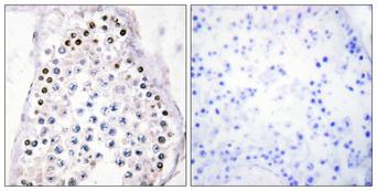 HOXA1/HOXB1/HOXD1 Antibody - Peptide - + Immunohistochemistry analysis of paraffin-embedded human testis tissue, using HOXA1/B1/D1 antibody.