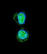 HOXA10 Antibody - Confocal immunofluorescence of HOXA10 Antibody with HepG2 cell followed by Alexa Fluor 488-conjugated goat anti-rabbit lgG (green). DAPI was used to stain the cell nuclear (blue).