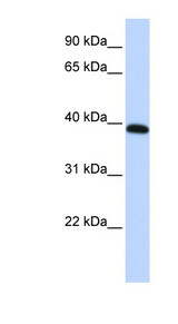HOXA10 Antibody - HOXA10 antibody Western blot of HepG2 cell lysate. This image was taken for the unconjugated form of this product. Other forms have not been tested.