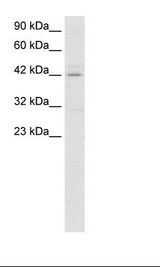HOXA10 Antibody - Jurkat Cell Lysate.  This image was taken for the unconjugated form of this product. Other forms have not been tested.