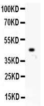 HOXA10 Antibody - HOXA10 antibody Western blot. All lanes: Anti HOXA10 at 0.5 ug/ml. WB: Recombinant Human HOXA10 Protein 0.5ng. Predicted band size: 45 kD. Observed band size: 45 kD.