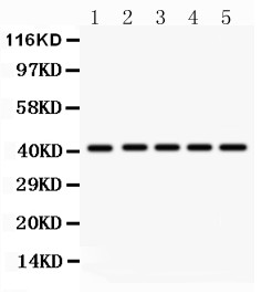HOXA10 Antibody - HOXA10 antibody Western blot. All lanes: Anti HOXA10 at 0.5 ug/ml. Lane 1: Rat Kidney Tissue Lysate at 50 ug. Lane 2: Human Placenta Tissue Lysate at 50 ug. Lane 3: HELA Whole Cell Lysate at 40 ug. Lane 4: SW620 Whole Cell Lysate at 40 ug. Lane 5: HEPA Whole Cell Lysate at 40 ug. Predicted band size: 41 kD. Observed band size: 41 kD.