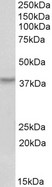 HOXA10 Antibody - (0.2?g/ml) staining of Human Skeletal Muscle lysate (35?g protein in RIPA buffer). Primary incubation was 1 hour. Detected by chemiluminescence.