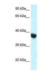 HOXA10 Antibody - HOXA10 antibody Western blot of Rat Muscle lysate. Antibody concentration 1 ug/ml.  This image was taken for the unconjugated form of this product. Other forms have not been tested.