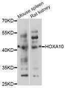 HOXA10 Antibody - Western blot analysis of extracts of various cell lines.