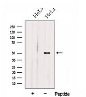 HOXA10 Antibody - Western blot analysis of extracts of HeLa cells using HOXA10 antibody. The lane on the left was treated with blocking peptide.