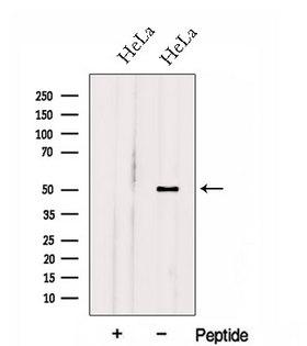 HOXA10 Antibody - Western blot analysis of extracts of HeLa cells using HOXA10 antibody. The lane on the left was treated with blocking peptide.