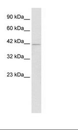 HOXA10 Antibody - HepG2 Cell Lysate.  This image was taken for the unconjugated form of this product. Other forms have not been tested.