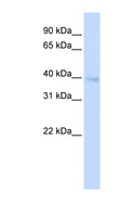 HOXA11 Antibody - HOXA11 antibody Western blot of Transfected 293T cell lysate. This image was taken for the unconjugated form of this product. Other forms have not been tested.