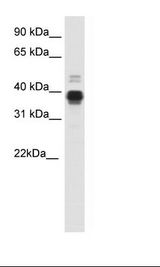 HOXA11 Antibody - Uterus Lysate.  This image was taken for the unconjugated form of this product. Other forms have not been tested.