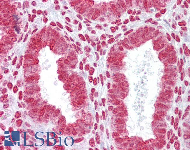 HOXA11 Antibody - Anti-HOXA11 antibody IHC of human uterus. Immunohistochemistry of formalin-fixed, paraffin-embedded tissue after heat-induced antigen retrieval. Antibody concentration 5 ug/ml.  This image was taken for the unconjugated form of this product. Other forms have not been tested.