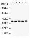 HOXA11 Antibody - HOXA11 antibody Western blot. All lanes: Anti HOXA11 at 0.5 ug/ml. Lane 1: Rat Brain Tissue Lysate at 50 ug. Lane 2: Human Placenta Tissue Lysate at 50 ug. Lane 3: HLEA Whole Cell Lysate at 40 ug. Lane 4: HT1080 Whole Cell Lysate at 40 ug. Lane 5: HEPA Whole Cell Lysate at 40 ug. Predicted band size: 35 kD. Observed band size: 35 kD.