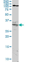HOXA11 Antibody - HOXA11 monoclonal antibody (M05), clone 8B8 Western blot of HOXA11 expression in HeLa NE.