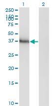HOXA11 Antibody - Western blot of HOXA11 expression in transfected 293T cell line by HOXA11 monoclonal antibody (M05), clone 8B8.