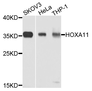 HOXA11 Antibody - Western blot analysis of extracts of HeLa cells.