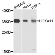 HOXA11 Antibody - Western blot analysis of extracts of HeLa cells.