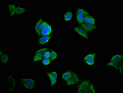 HOXA11 Antibody - Immunofluorescence staining of PC-3 cells with HOXA11 Antibody at 1:33, counter-stained with DAPI. The cells were fixed in 4% formaldehyde, permeabilized using 0.2% Triton X-100 and blocked in 10% normal Goat Serum. The cells were then incubated with the antibody overnight at 4°C. The secondary antibody was Alexa Fluor 488-congugated AffiniPure Goat Anti-Rabbit IgG(H+L).