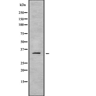 HOXA11 Antibody - Western blot analysis of HOXA11 using COS7 whole cells lysates