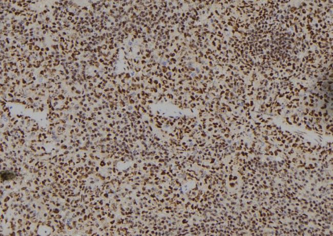 HOXA11 Antibody - 1:100 staining mouse spleen tissue by IHC-P. The sample was formaldehyde fixed and a heat mediated antigen retrieval step in citrate buffer was performed. The sample was then blocked and incubated with the antibody for 1.5 hours at 22°C. An HRP conjugated goat anti-rabbit antibody was used as the secondary.