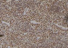 HOXA11 Antibody - 1:100 staining mouse spleen tissue by IHC-P. The sample was formaldehyde fixed and a heat mediated antigen retrieval step in citrate buffer was performed. The sample was then blocked and incubated with the antibody for 1.5 hours at 22°C. An HRP conjugated goat anti-rabbit antibody was used as the secondary.