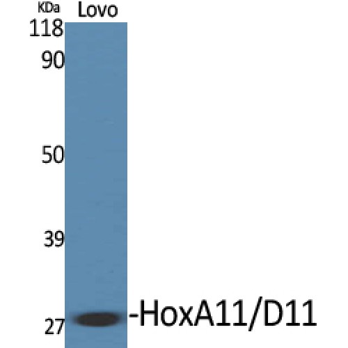 HOXA11+HOXD11 Antibody - Western blot of HoxA11/D11 antibody